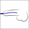 Kék szilikon húgycsőtágító - DILATOR - 3 db